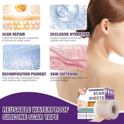 Silicone Scar Sheets