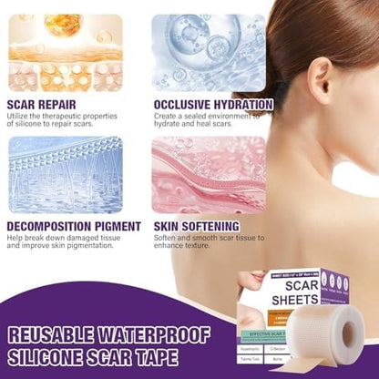 Silicone Scar Sheets