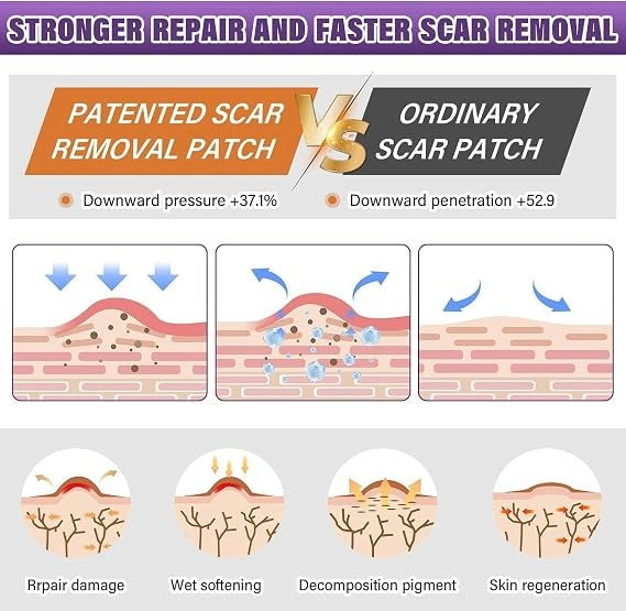 Silicone Scar Sheets