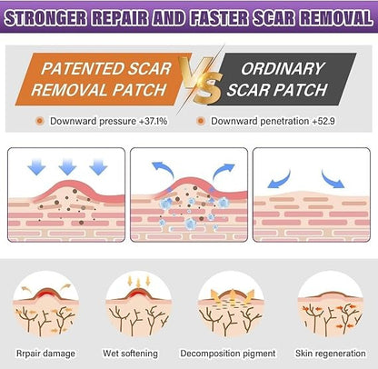 Silicone Scar Sheets