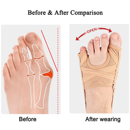 Unisex Bunion Corrector Big Toe & Tail Toe Pain Relief
